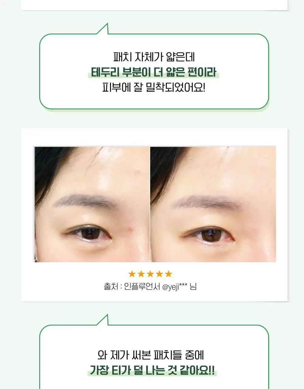[단독기획] 마데카 메디패치 스팟패치 (33매/99매) 상세페이지 7